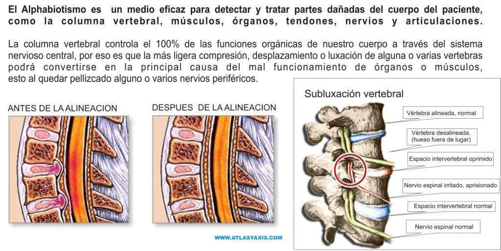 compresion_nerviosa